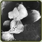 Wounds left by the sucker-mouth of a Giardia Parasite